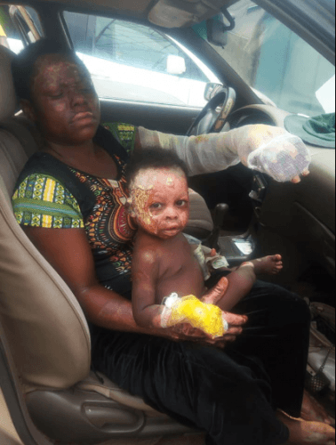 So Heartbreaking!! Woman And Her 4 Children Burnt After Fire Outbreak In Anambra (Graphic Photos)