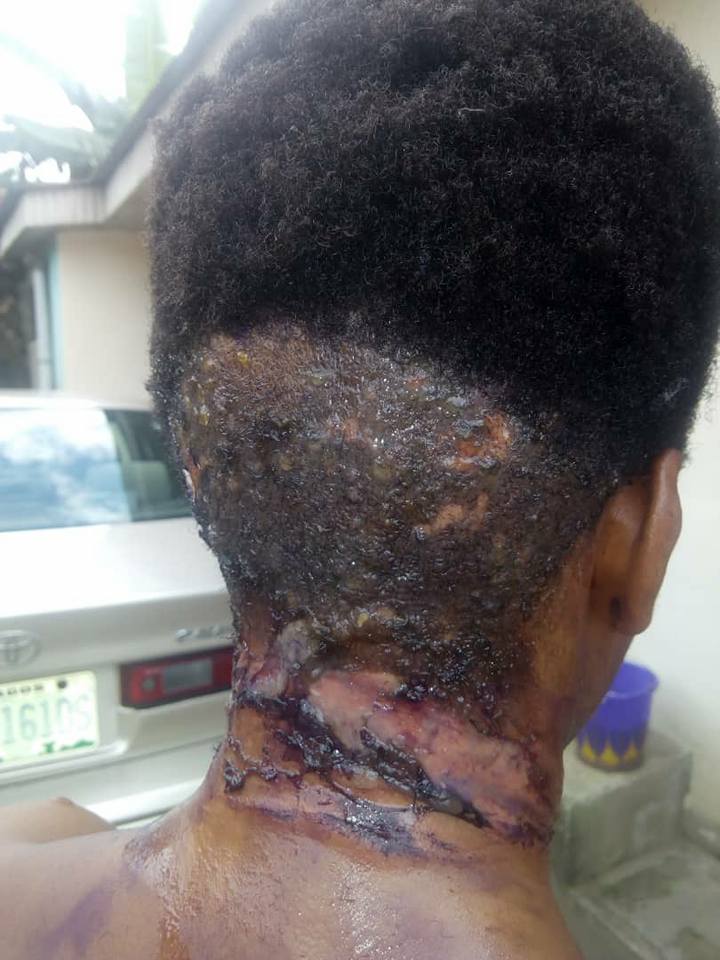 Landlady On The Run After Bathing Her Female Tenant With Boiling Water Over N380 Light Bill (Photos)