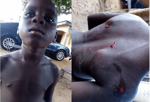 Lecturer Brutalizes Houseboy For Misplacing His Books (Graphic Photos)