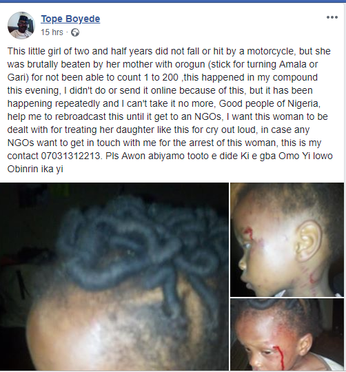 2-Year-Old Girl Brutalized By Mother Over Failure To Count (Photos)